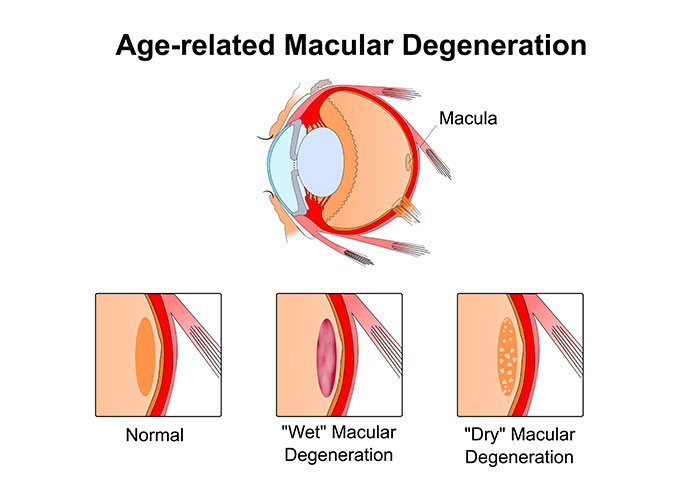 Diagram of eyes