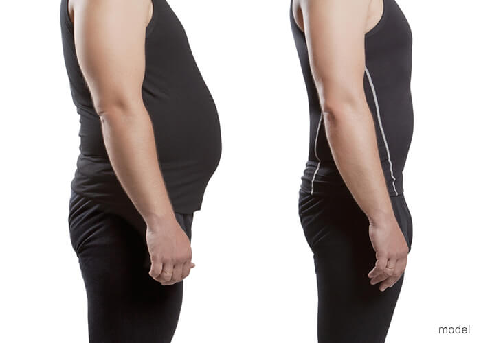 Before and after of weight loss